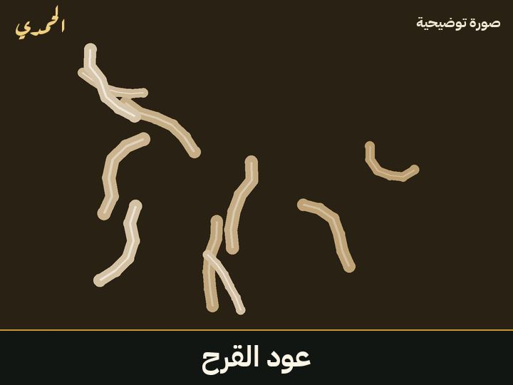 عود القرح